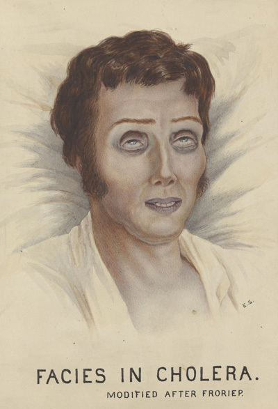 Faces of cholera 400.jpg